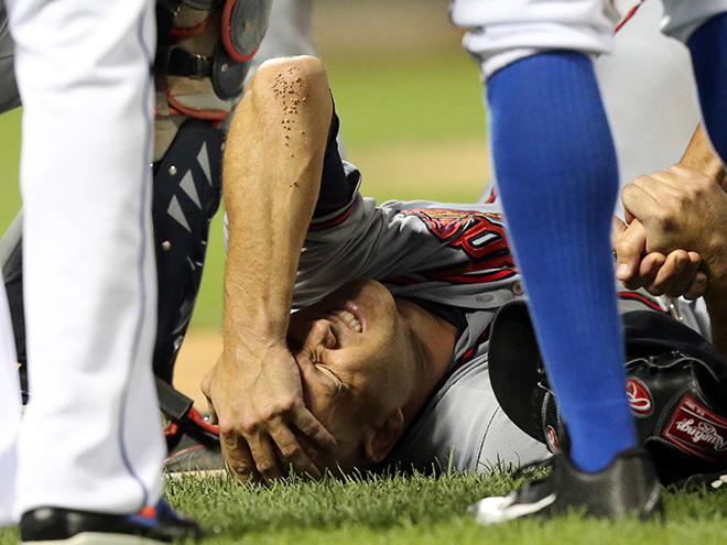 Atlanta Braves starting pitcher Tim Hudson (15) reacts after being injured in a collision at first base. (Anthony Gruppuso, USA TODAY Sports)