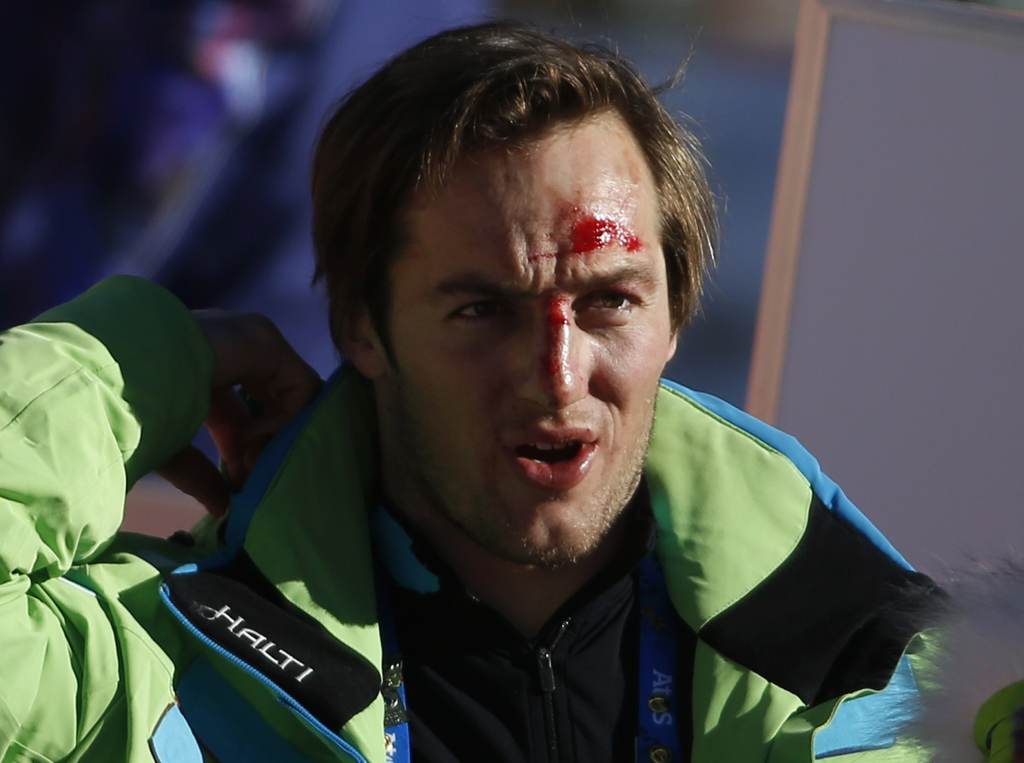 Rok Perko's bloodied face after spill. (Reuters)