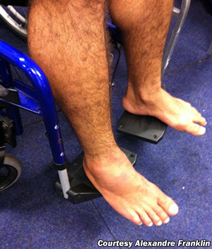 rousimar-palhares-broken-foot.jpg