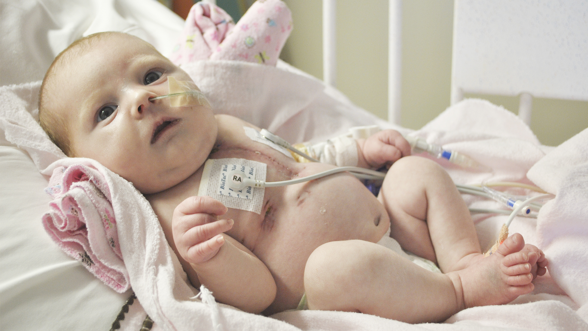 Emerson Rose spent two and a half months after having open-heart surgery at four days old recovering at the pediatric heart center at the Medical University of South Carolina (MUSC) in Charleston. She passed away on June 26, 2011. She was just 76 days old. (Photo courtesy of the Emerson Rose Heart Foundation.)