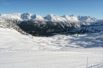 Whistler Blackcomb | Photo Credit: