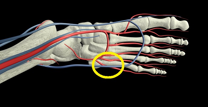 Kevin durant deals flat feet