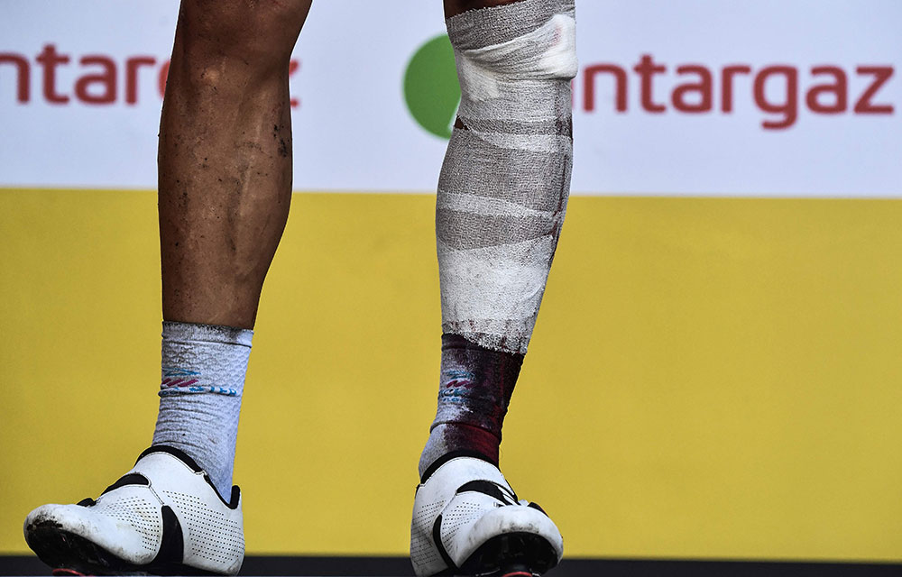Tour de France rider reveals gruesome leg injury