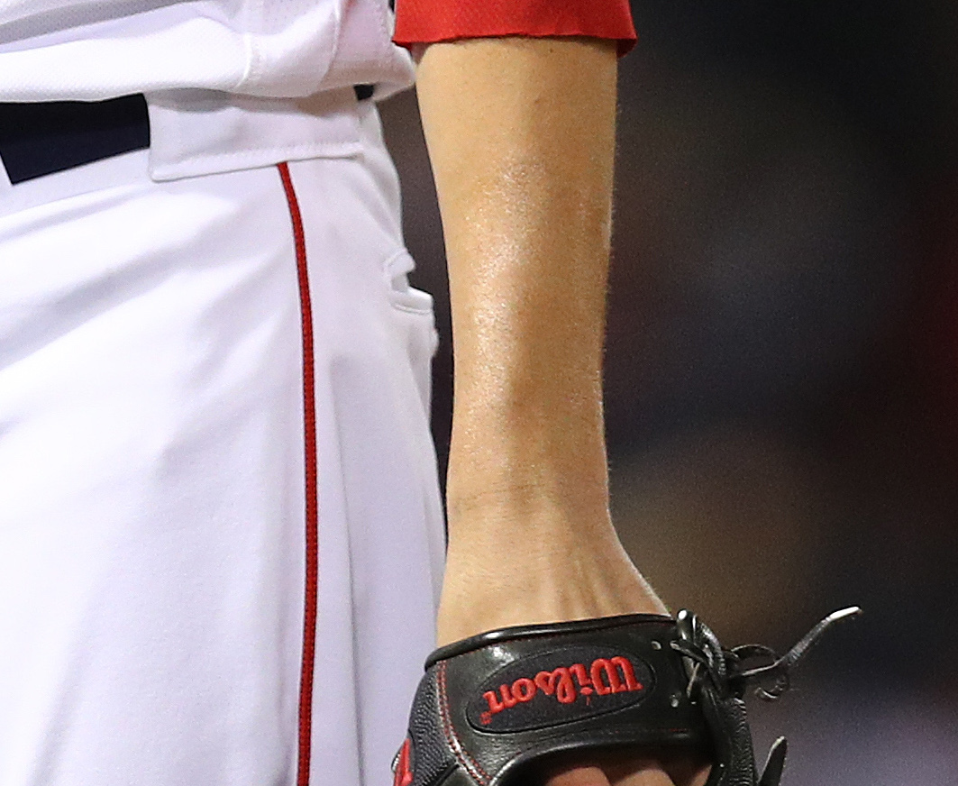 MLB pitchers using pine tar is against the rules, but everyone's OK with it