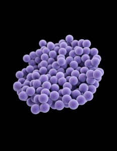 A cluster of methicillin-resistant Staphylococcus aureus (MRSA) bacteria. MRSA can cause skin infections, blood stream infections and pneumonia. Photo: US Center for Disease Control and Prevention